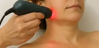 Tratamiento de fotobiomodulación PBM — cicatrización de úlceras orales